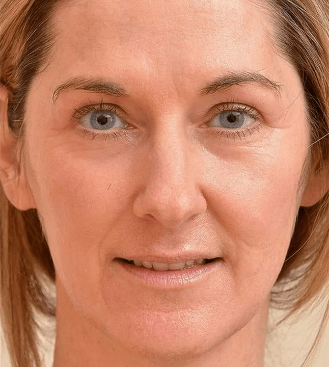 Eu pareço mais jovem depois de aplicar o creme Eudalie